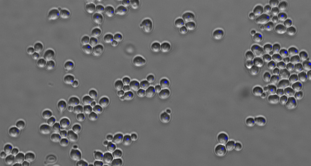 Yeast